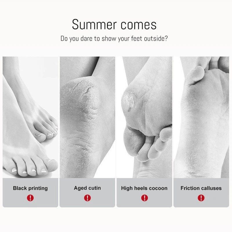 Foot Mask That Peels Skin factory