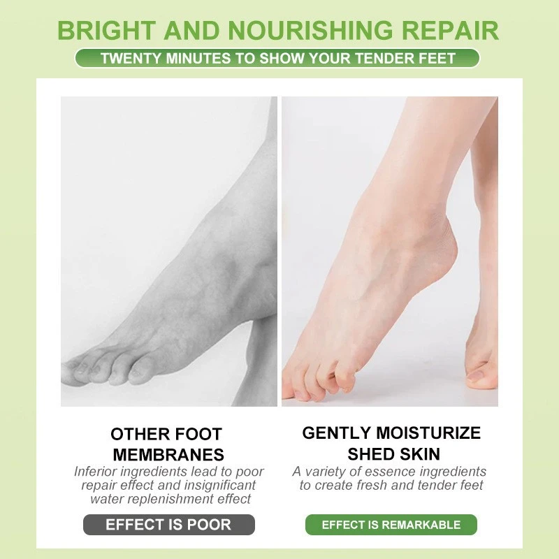 Foot Mask That Peels Skin best